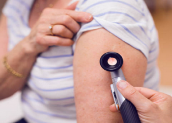 علماء يحذرون من قاتل يعيش على جلد الجميع!