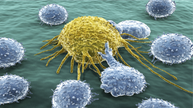 طريقة جديدة لعلاج سرطان البنكرياس